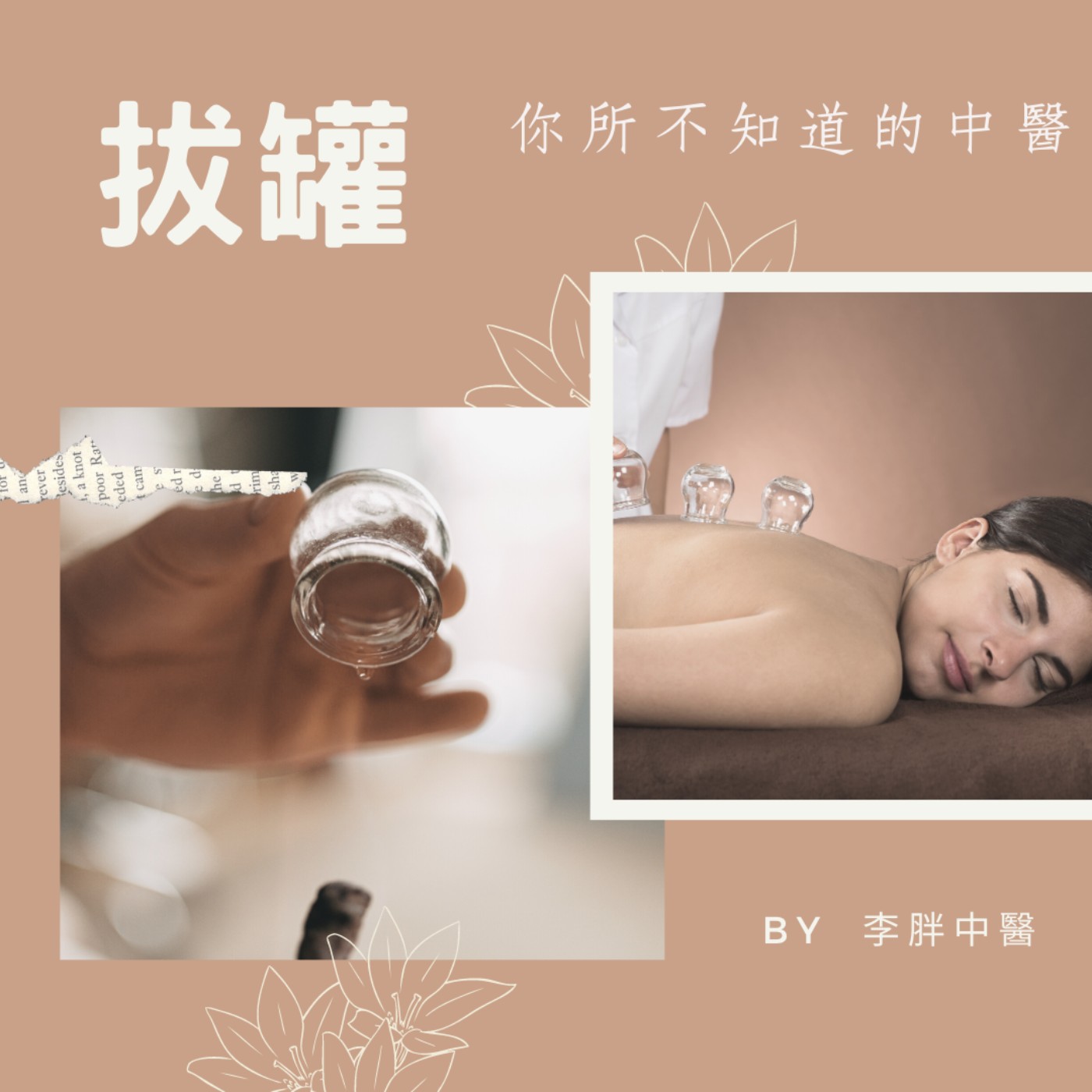 你所不知道的中醫系列~~拔罐 你所不知道的中醫系列~~拔罐