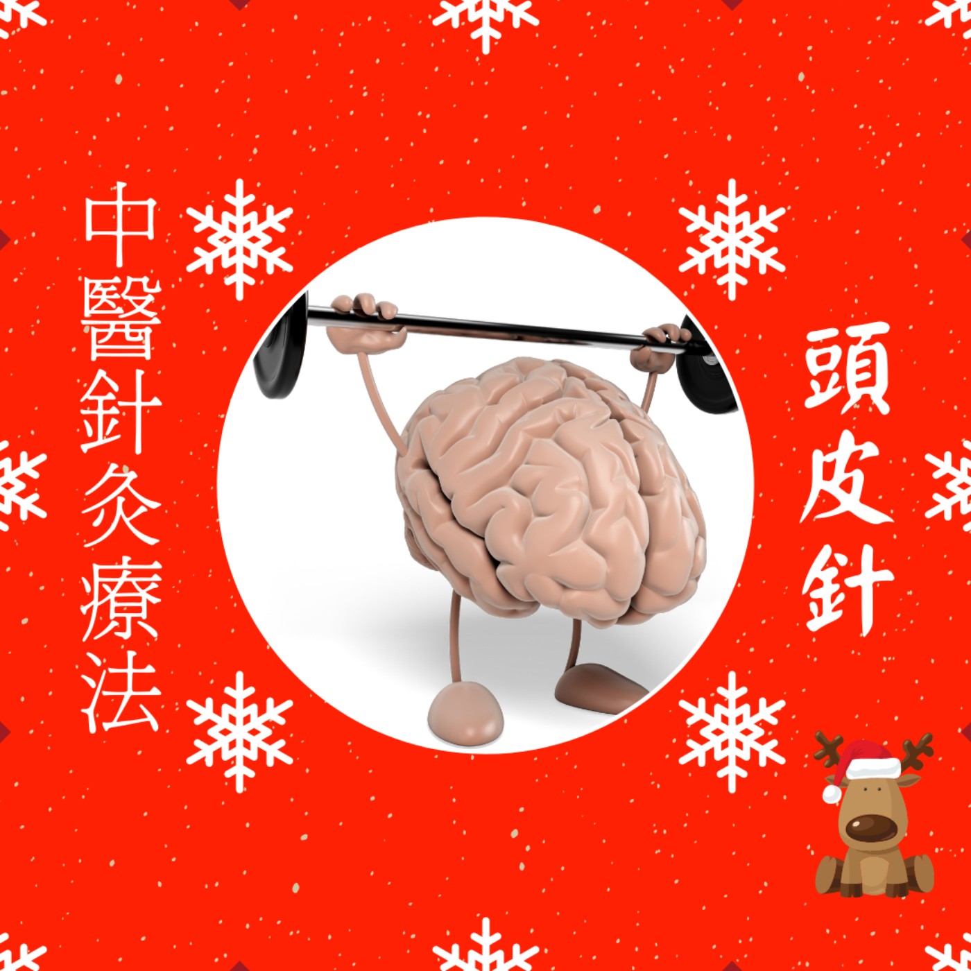 中醫針灸療法~頭皮針 (治療中風的專門針法) 中醫針灸療法~頭皮針 (治療中風的專門針法)