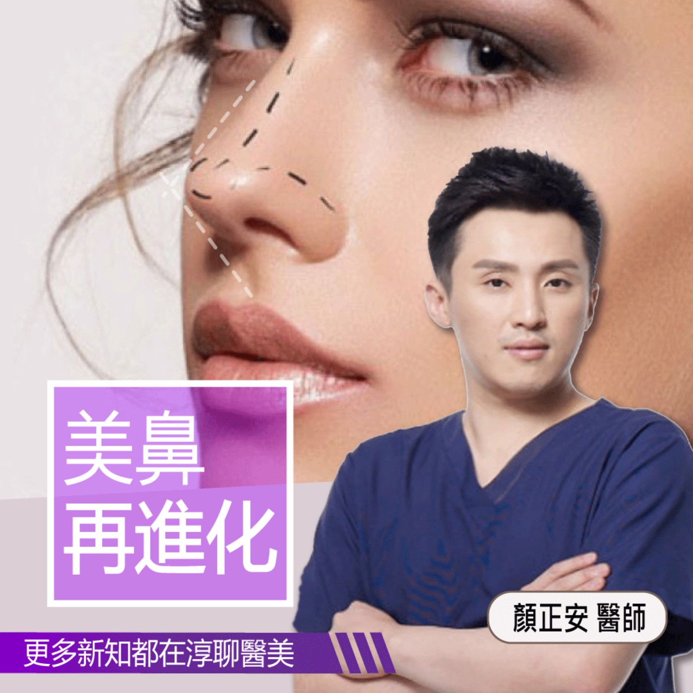 愛惟美【EP17】美鼻再進化~隆鼻後face更立體  feat.顏正安醫師 episode artwork