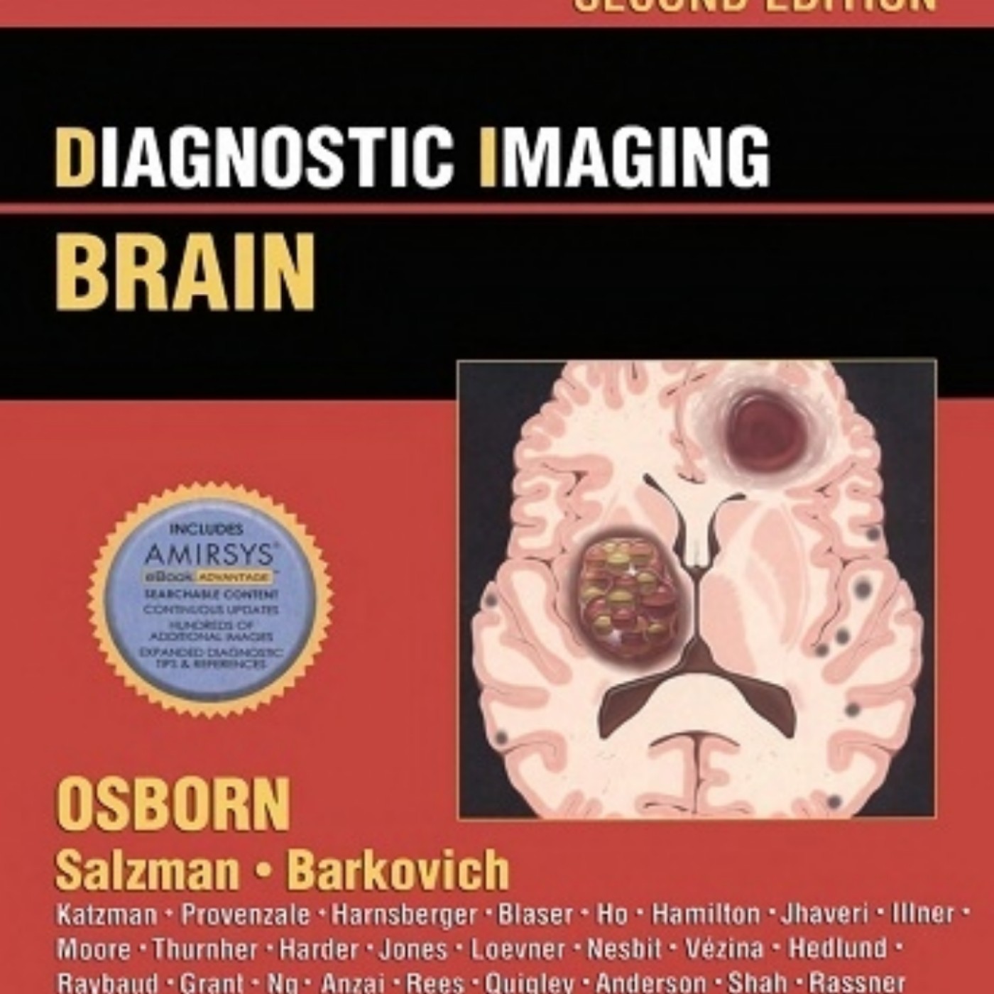 Diagnostic Imaging Brain Osborn 2nd Edition.pdf | Podcast on SoundOn