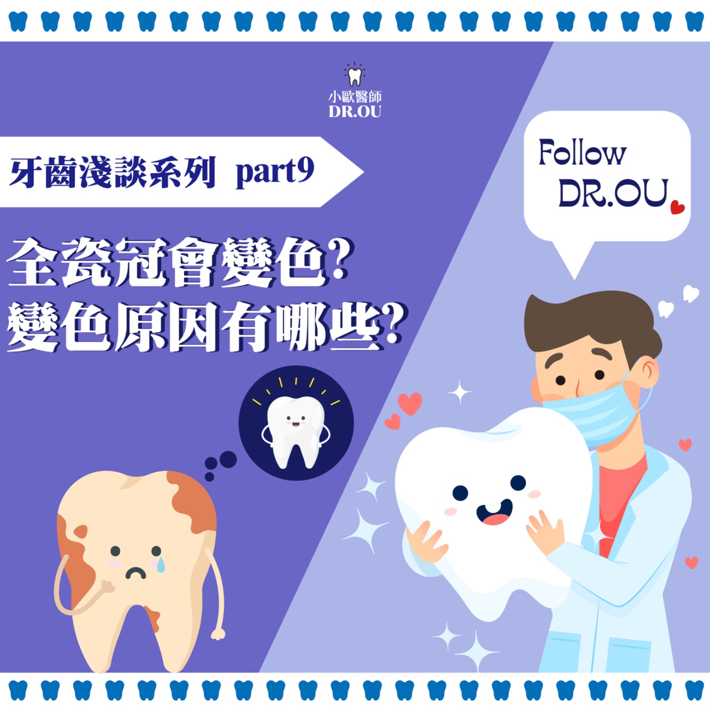 全瓷假牙會變色嗎？