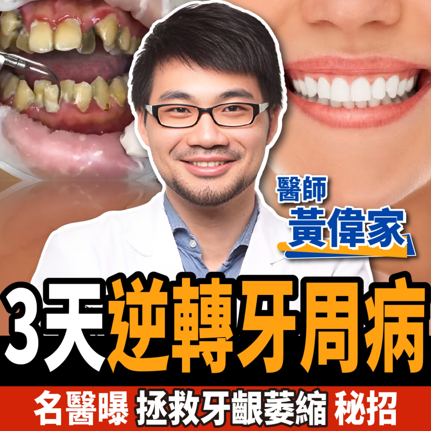 cover of episode 【下班經濟學＿健康】牙齦萎縮怎麼救？名醫曝3天逆轉牙周病、口臭關鍵：一輩子不用植牙！ft.牙醫師黃偉家