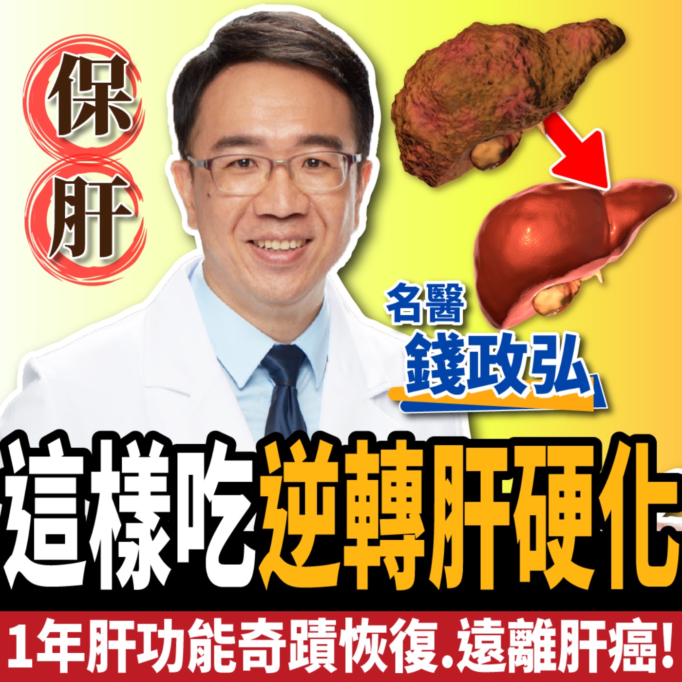 cover of episode 【下班經濟學＿健康】這樣吃狂降脂肪肝!名醫曝保肝3類超級食物：奇蹟遠離肝癌、肝硬化！ft. 錢政弘醫師 