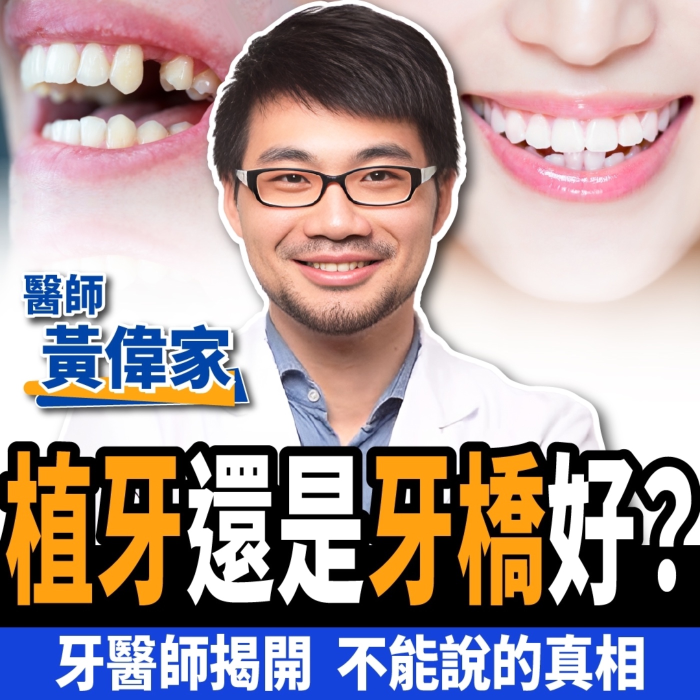 cover of episode 【下班經濟學＿健康】千萬別急著植牙！名醫揭開不能說的真相：拔牙前3件事不可不知！ft.牙醫師黃偉家｜牙橋