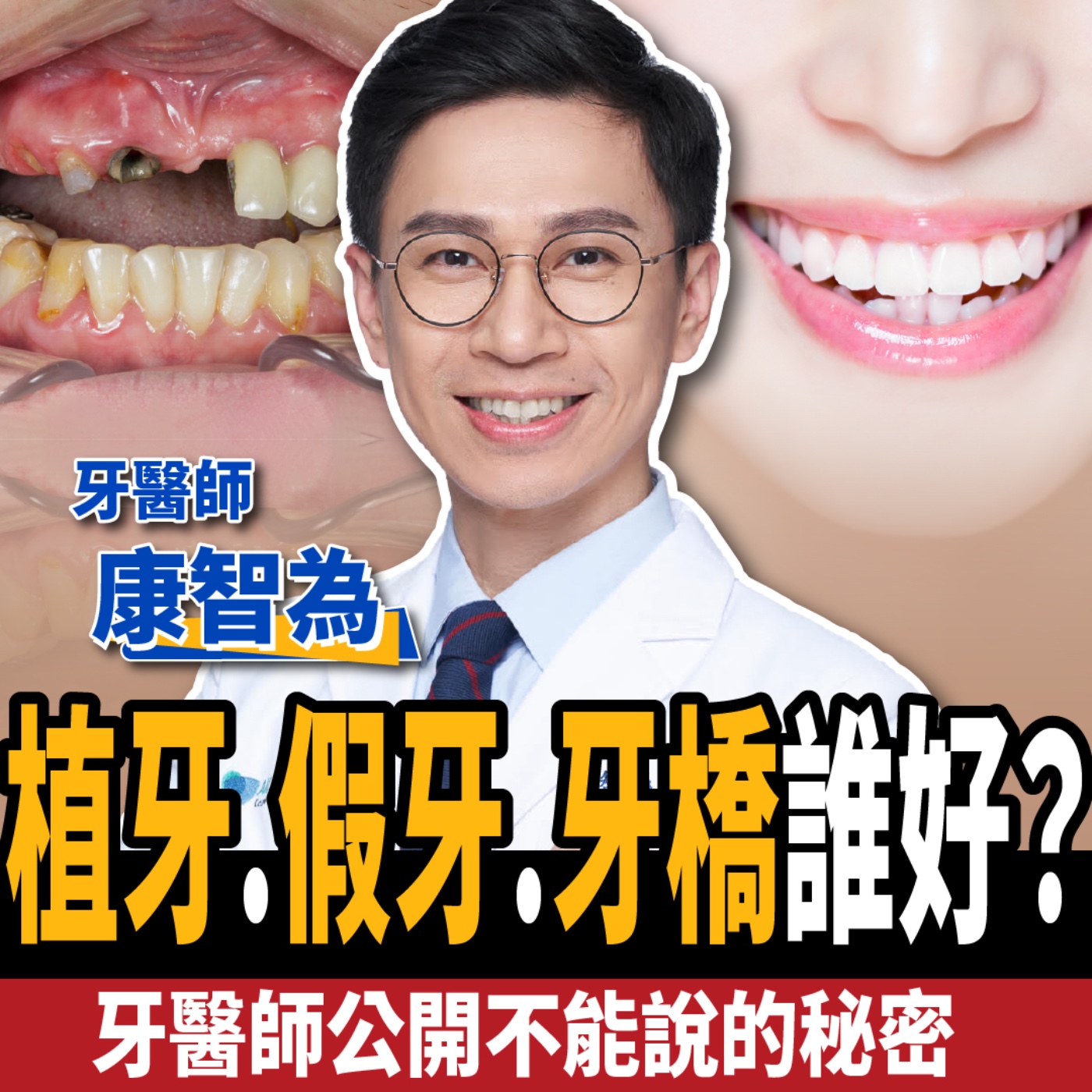 cover of episode 【下班經濟學＿健康】滿口缺牙怎麼辦？名醫公開植牙、牙橋、假牙不能說的秘密！ft.牙醫師 康智為