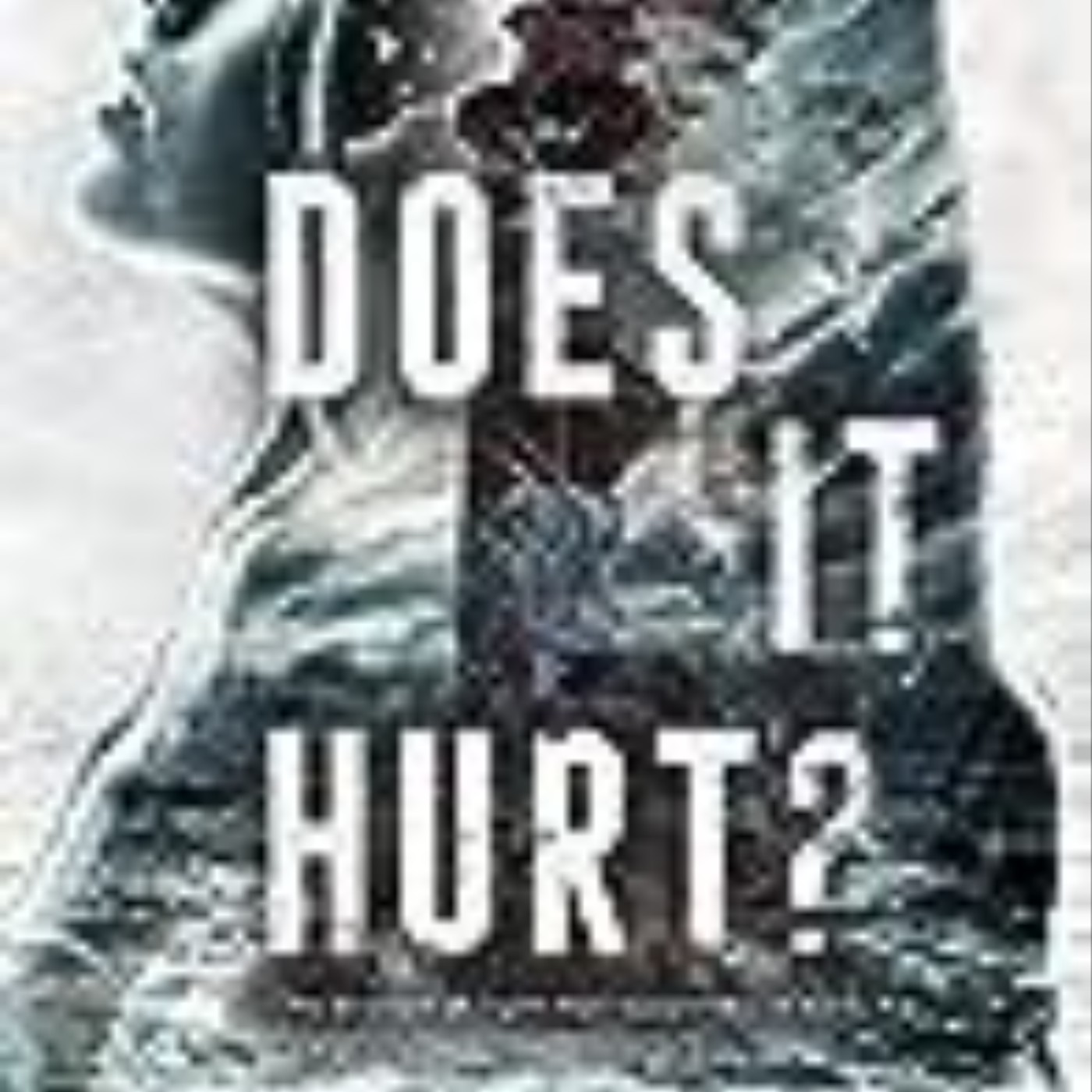 Books Download Does It Hurt? Full Access