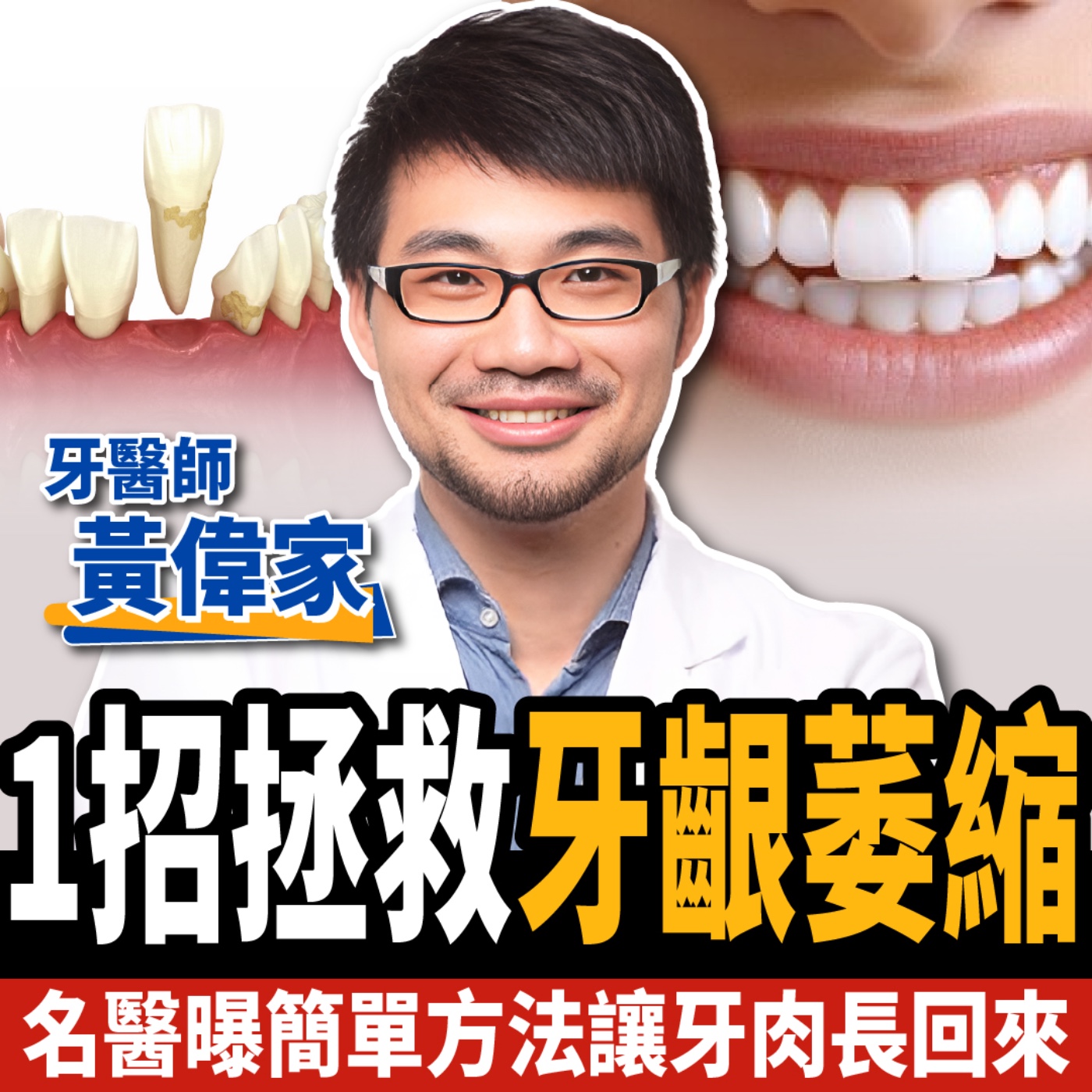 cover of episode 【下班經濟學＿健康】牙齦萎縮怎麼救？名醫曝簡單一招長回牙肉：告別牙周病！ft.牙醫黃偉家