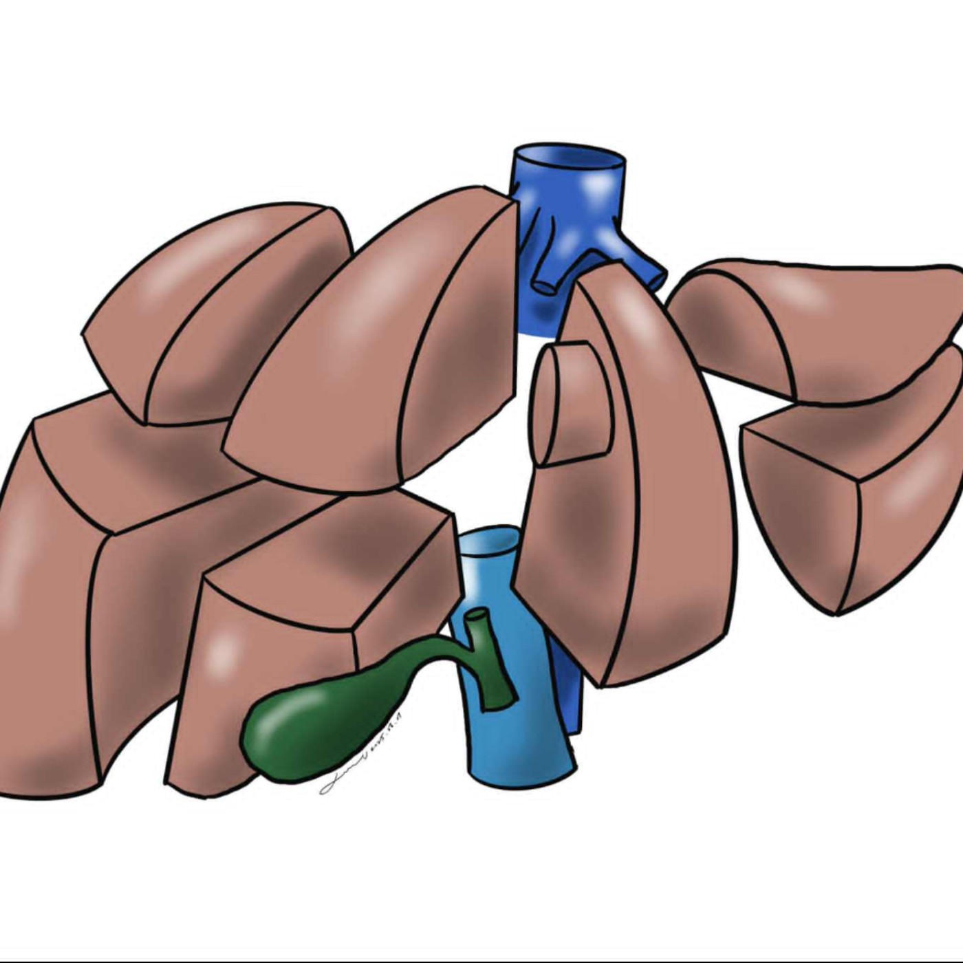 S02E03 肝臟的良性腫瘤