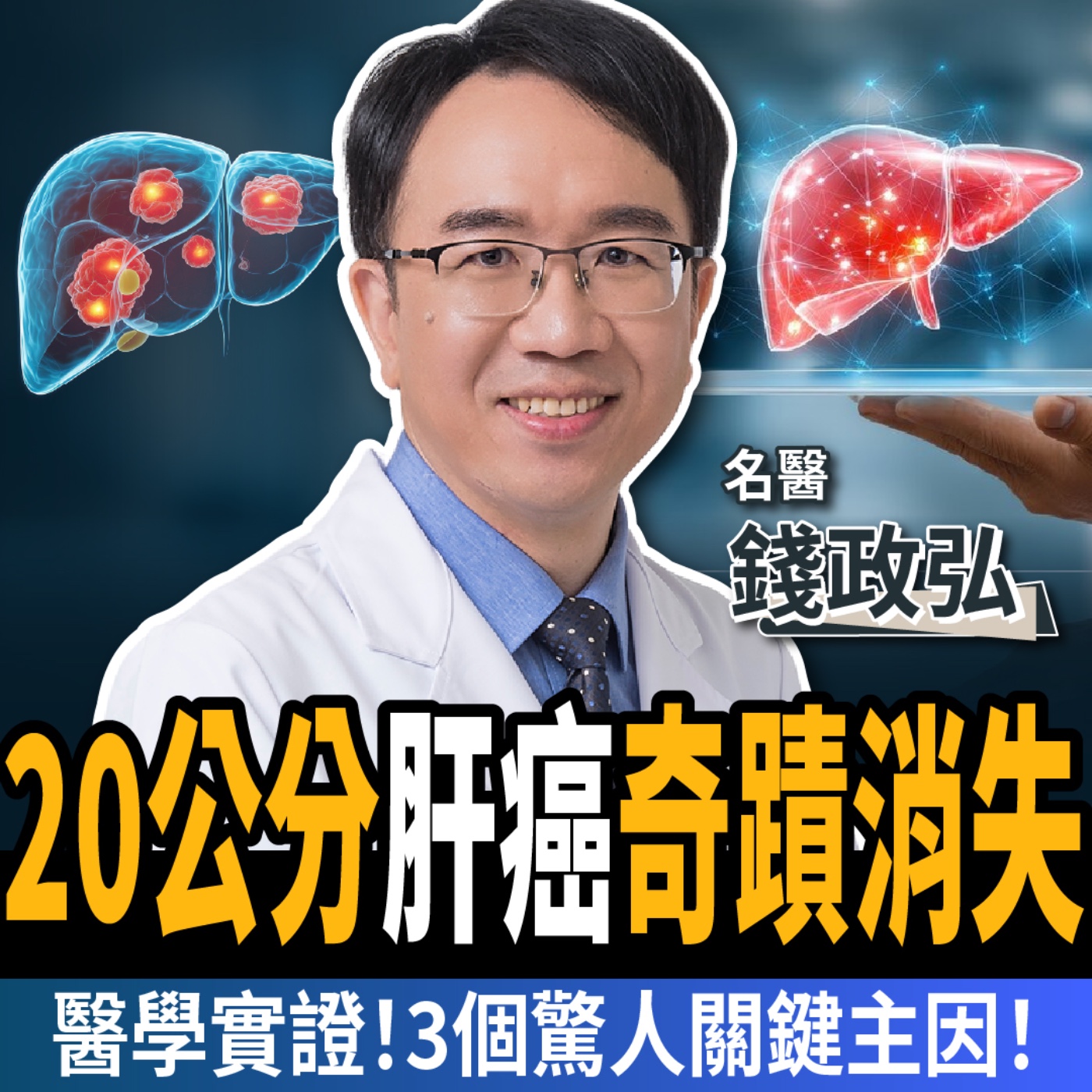 【下班經濟學_健康】沒開刀！肝癌竟自己消失！名醫公開「醫學實證」3關鍵！ft. 錢政弘醫師