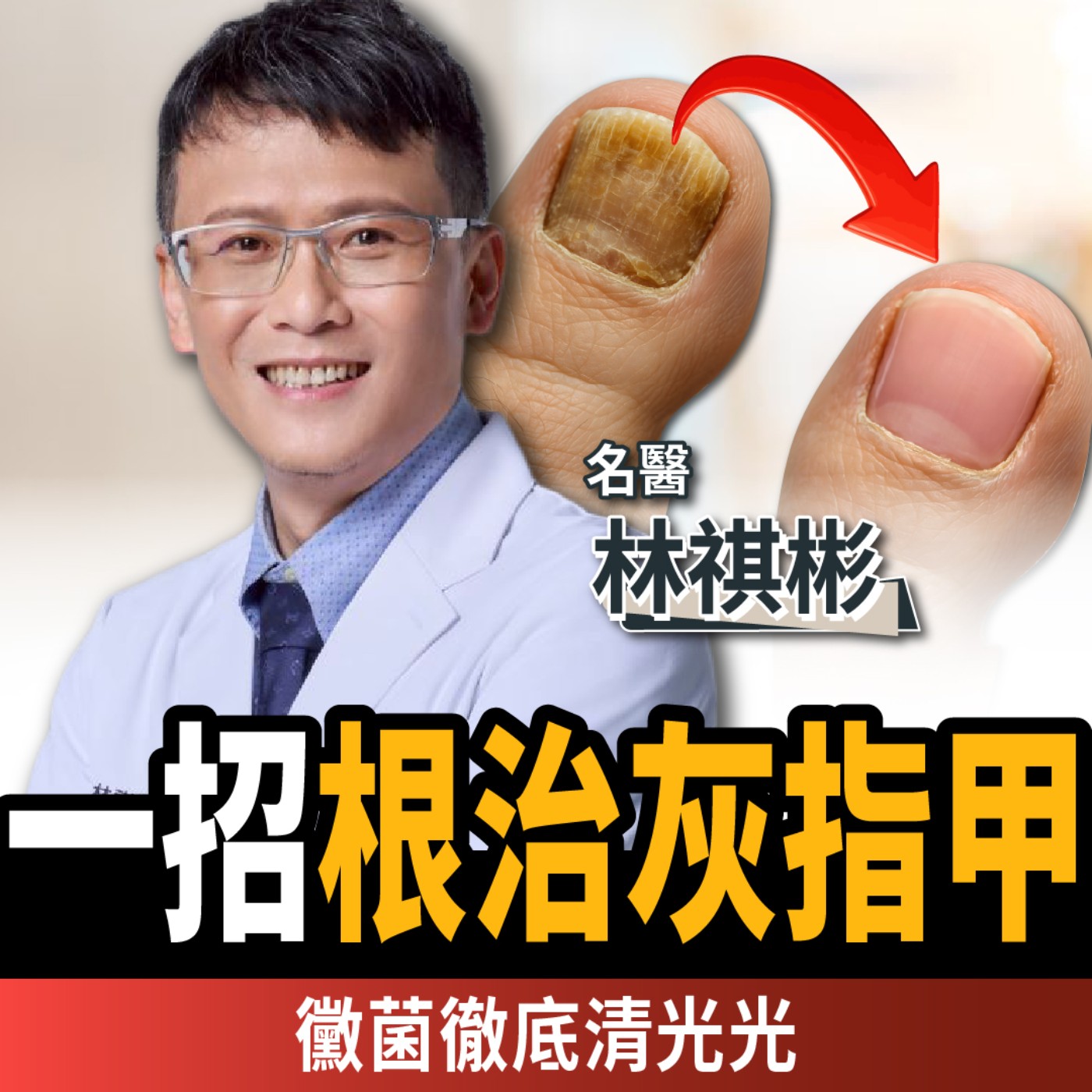 【下班經濟學＿健康】注意！別再亂擦藥膏！醫師公開真正根治方法，黴菌一次清乾淨！ft. 林祺彬醫師｜灰指甲｜謝哲青、蔡尚樺